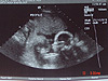 Baby's profile