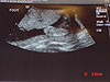 Baby's foot