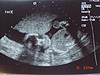 Baby's head