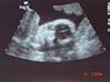 Baby's face
