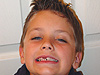Tyler's second lost tooth